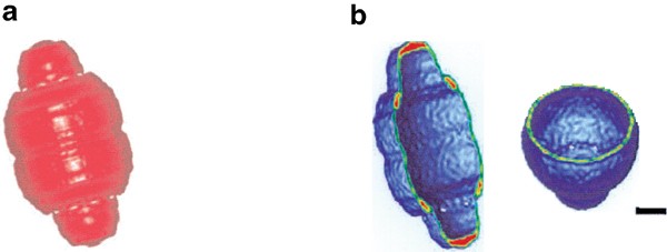 Vaults: a ribonucleoprotein particle involved in drug resistance?