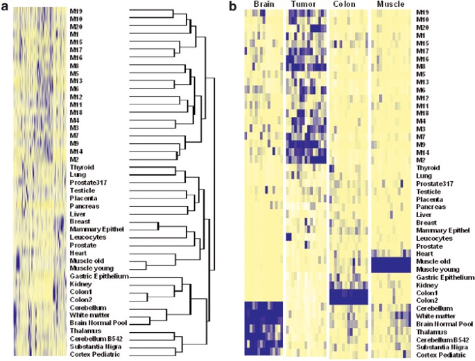 Comparison of medulloblastoma and normal neural transcriptomes identifies a restricted set of activated genes