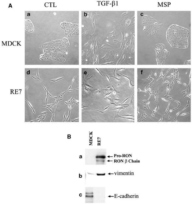 Collaborative activities of macrophage-stimulating protein and transforming growth factor-β1 in induction of epithelial to mesenchymal transition: rol
