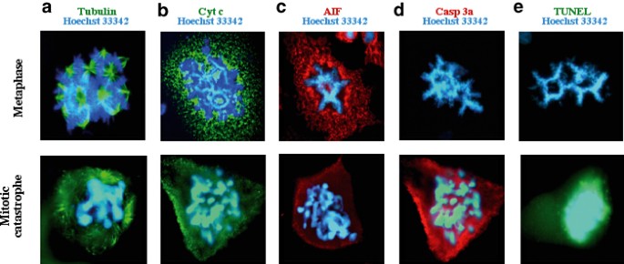 Cell death by mitotic catastrophe: a molecular definition Biology Diagrams