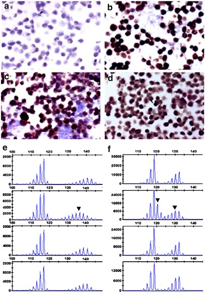 Restoring mismatch repair does not stop the formation of reciprocal translocations in the colon cancer cell line hca7 but further destabilizes chromos