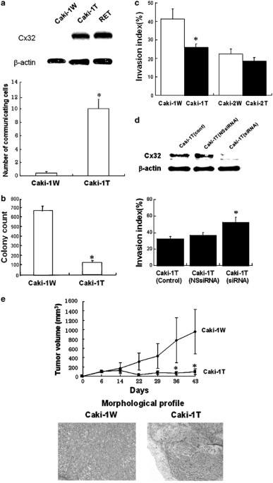 Connexin32 as a tumor suppressor gene in a metastatic renal cell carcinoma cell line
