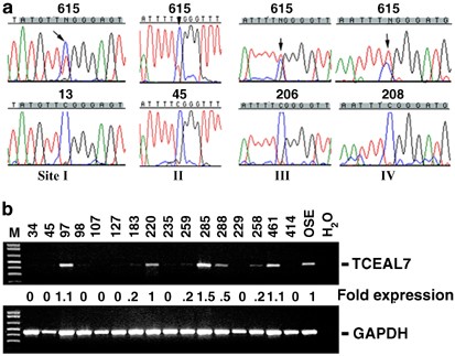 Epigenetic silencing of TCEAL7 (Bex4) in ovarian cancer