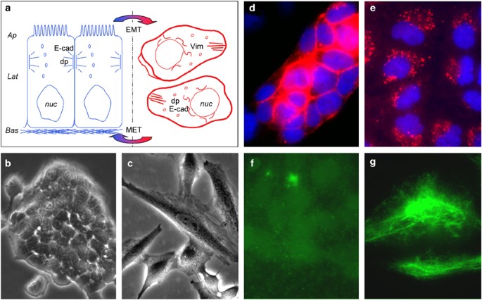 Epithelial Mesenchymal Transition In Development And Cancer Role Of Phosphatidylinositol 3 Kinase Akt Pathways Oncogene