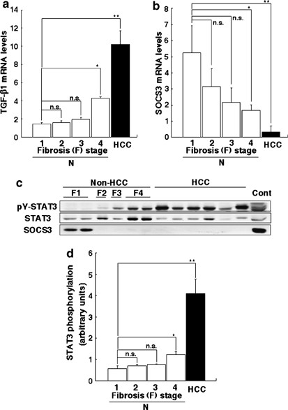 Loss of socs3 in the liver promotes fibrosis by enhancing stat3-mediated tgf-β1 production