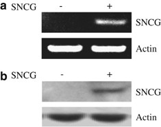Chaperoning of estrogen receptor and induction of mammary gland proliferation by neuronal protein synuclein gamma