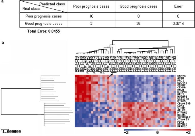 Molecular profiling related to poor prognosis in thyroid carcinoma.  Combining gene expression data and biological information | Oncogene