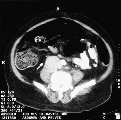 feature-image