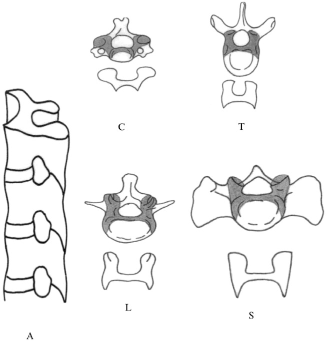 Classification of spinal injuries based on the essential traumatic