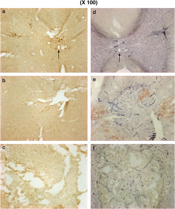 Changes in nitric oxide synthase expression in young and adult rats after spinal cord injury