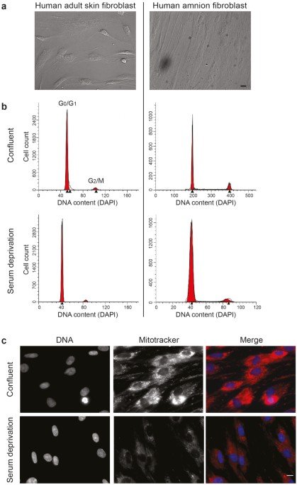therapeutic potential of somatic cell nuclear transfer for thank you for visiting