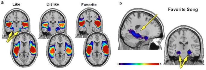 Music in the brain  Nature Reviews Neuroscience