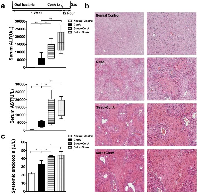 Natural killer t cells play a necessary role in modulating of immune-mediated liver injury by gut microbiota