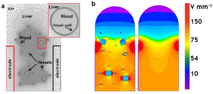 Tissue Heterogeneity In Structure And Conductivity Contribute To Cell Survival During Irreversible Electroporation Ablation By Electric Field Sinks Scientific Reports