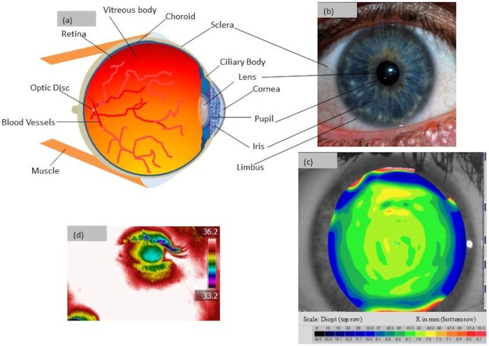 Imaging Shear Stress Distribution And Evaluating The Stress Concentration Factor Of The Human Eye Scientific Reports