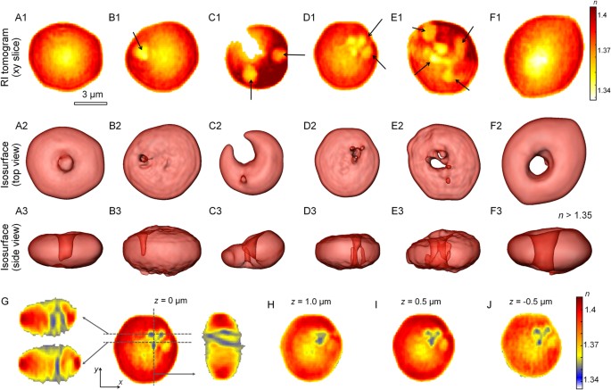 Characterizations of individual mouse red blood cells parasitized by  Babesia microti using 3-D holographic microscopy | Scientific Reports
