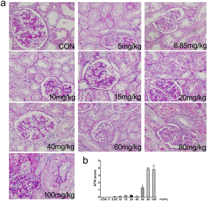 Rapamycin protects against gentamicin-induced acute kidney injury via ...