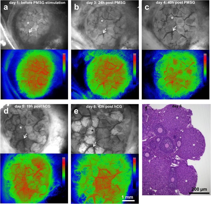 Minimally invasive longitudinal intravital imaging of cellular dynamics in  intact long bone