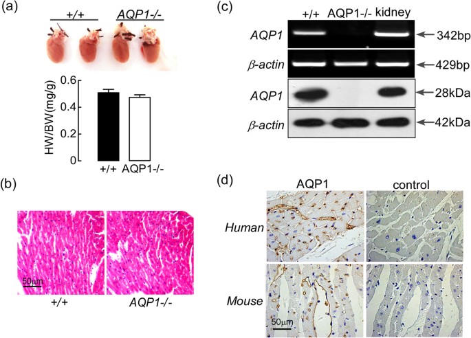 Aquaporin-1 Deficiency Protects Against Myocardial Infarction by Reducing  Both Edema and Apoptosis in Mice | Scientific Reports
