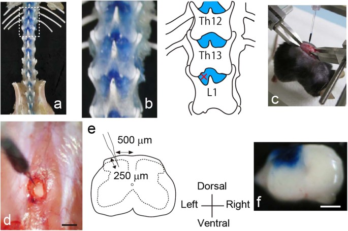 A new minimally-invasive method for microinjection into the mouse spinal  dorsal horn | Scientific Reports