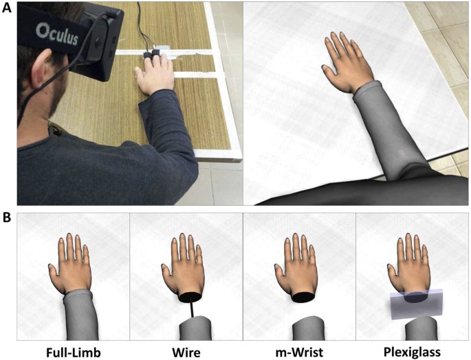 Rubber hand shows brain can be fooled on skin colour