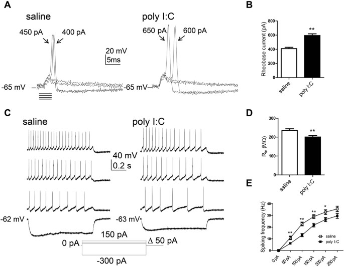 Maternal immune activation produces neonatal excitability defects in offspring hippocampal neurons from pregnant rats treated with poly I:C