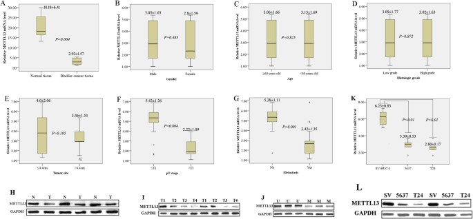 Retracted article: mettl13 is downregulated in bladder carcinoma and suppresses cell proliferation, migration and invasion