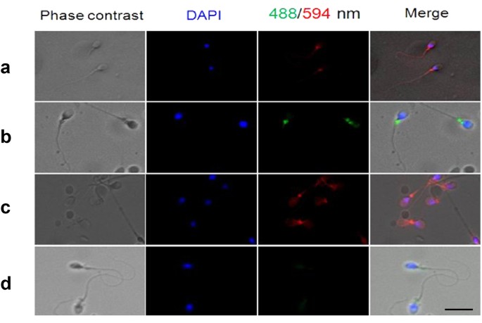 Immunoglobulin G Expression in Human Sperm and Possible Functional  Significance | Scientific Reports