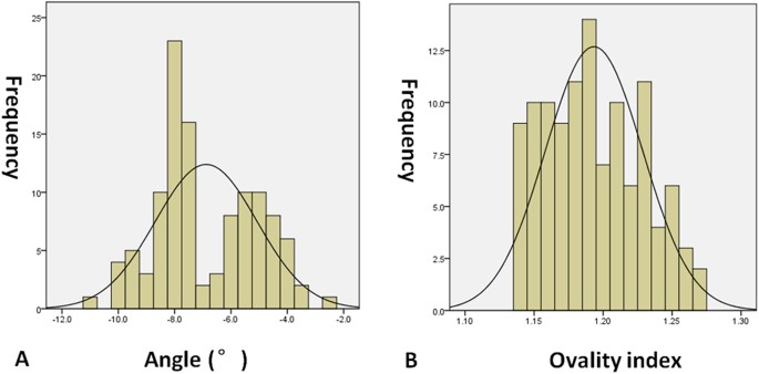 Detection of preperimetric glaucoma using bruch membrane opening, neural canal and posterior pole asymmetry analysis of optical coherence tomography