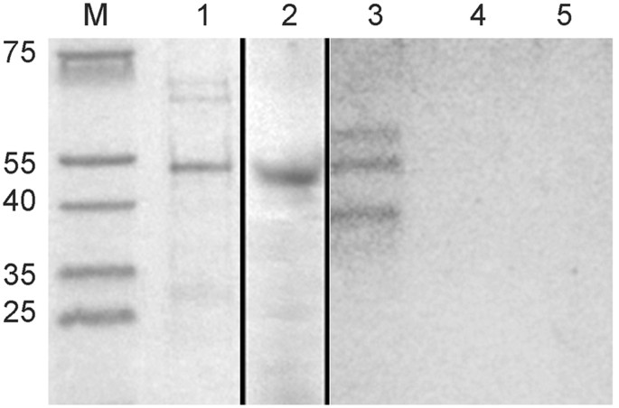 Oral Immunization Of Rabbits With S Enterica Typhimurium Expressing Neisseria Gonorrhoeae Filamentous Phage F6 Induces Bactericidal Antibodies Against N Gonorrhoeae Scientific Reports