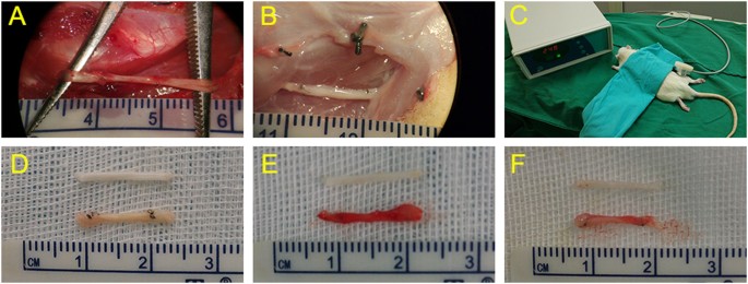 glutathione nerve repair hyperacusis Low-intensity pulsed ultrasound treatment improved the rate of autograft  peripheral nerve regeneration in rat