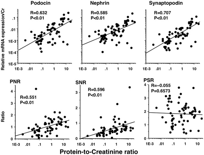 There is no correlation between podocyturia and the variables age