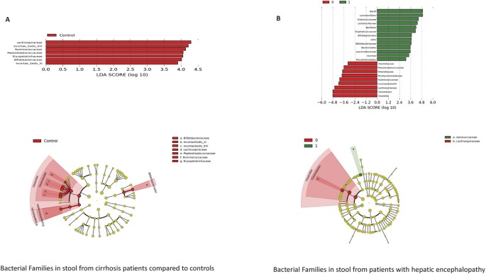 Impaired gut-liver-brain axis in patients with cirrhosis