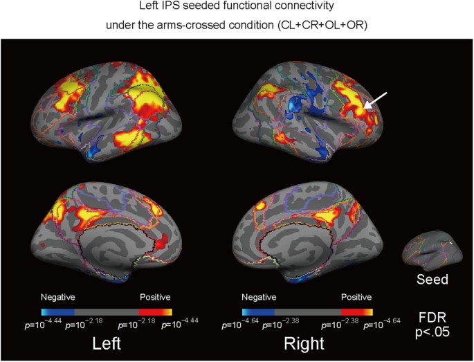 Arm Crossing Updates Brain Functional Connectivity Of The Left Posterior Parietal Cortex Scientific Reports