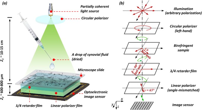 Wide-field imaging of birefringent synovial fluid crystals using lens-free polarized  microscopy for gout diagnosis | Scientific Reports