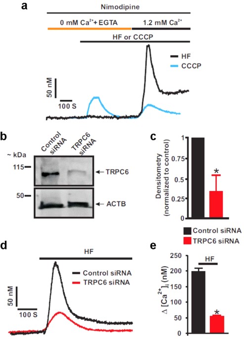 Trpc6 Channel Activation Promotes Neonatal Glomerular Mesangial