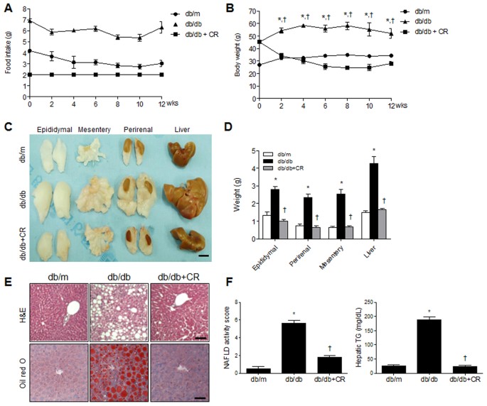 Caloric restriction of db/db mice reverts hepatic steatosis and body weight  with divergent hepatic metabolism | Scientific Reports