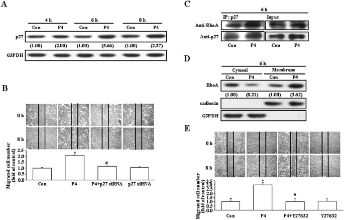Molecular mechanisms underlying progesterone-enhanced breast cancer cell migration