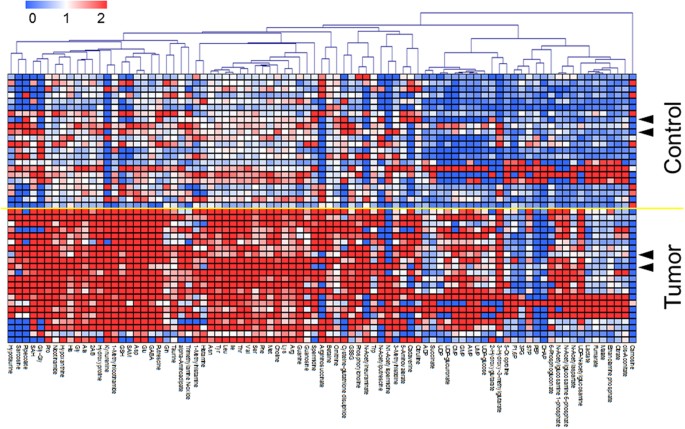 Identification of salivary metabolomic biomarkers for oral cancer screening  | Scientific Reports