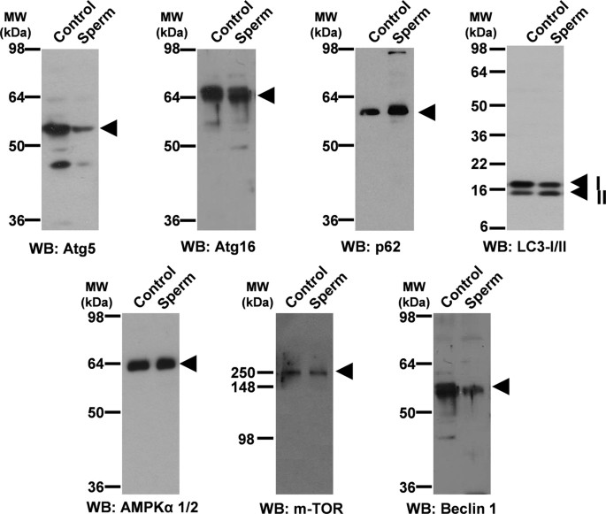 autophagy related proteins are functionally active in human spermatozoa and may be involved in the regulation of cell survival and motility scientific reports