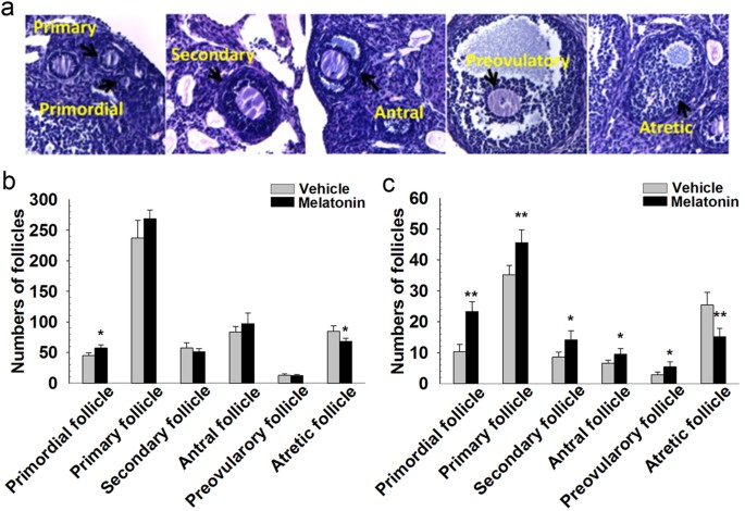 Melatonin improves age-induced fertility decline and attenuates ovarian mitochondrial oxidative stress in mice | Scientific Reports Melatonin improves age-induced fertility decline and attenuates ovarian mitochondrial oxidative stress in mice | Scientific Reports