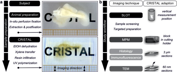 A combined method for correlative 3d imaging of biological samples from macro to nano scale