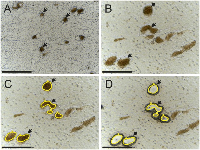 Proteomic characterization of neuromelanin granules isolated from human substantia nigra by laser-microdissection