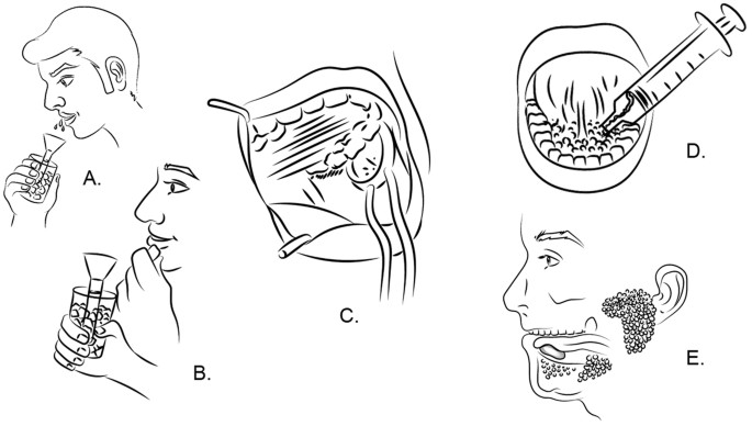 The proteomic profile of whole and glandular saliva in healthy pain-free subjects