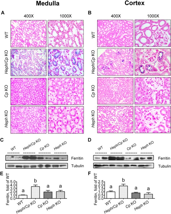 Hephaestin and ceruloplasmin facilitate iron metabolism in the mouse kidney  | Scientific Reports