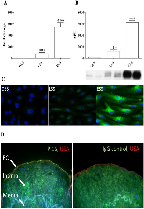 Pi16 Is A Shear Stress And Inflammation Regulated Inhibitor Of Mmp2 Scientific Reports