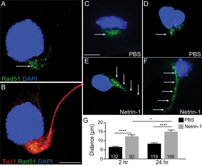 RAD51AP1 regulates ALT-HDR through chromatin-directed homeostasis of TERRA  - ScienceDirect