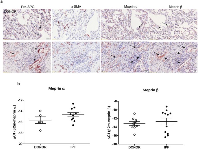 Meprin B Contributes To Collagen Deposition In Lung Fibrosis Scientific Reports