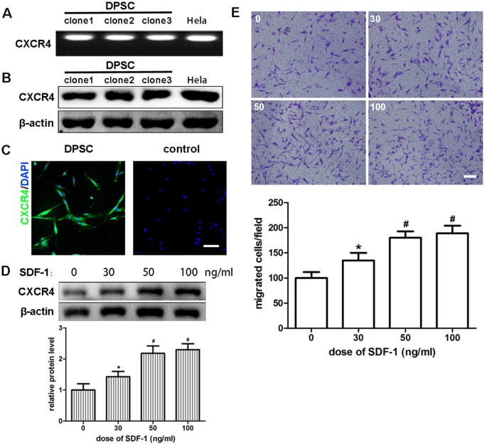 Sdf 1 Cxcr4 Axis Induces Human Dental Pulp Stem Cell Migration Through Fak Pi3k Akt And Gsk3b B Catenin Pathways Scientific Reports Sdf 1 Cxcr4 Axis Induces Human Dental Pulp Stem Cell Migration Through Fak Pi3k Akt And Gsk3b B Catenin Pathways Scientific Reports