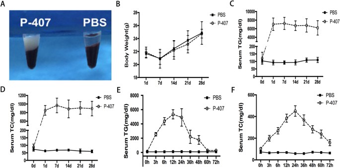 Development of a novel model of hypertriglyceridemic acute pancreatitis in mice